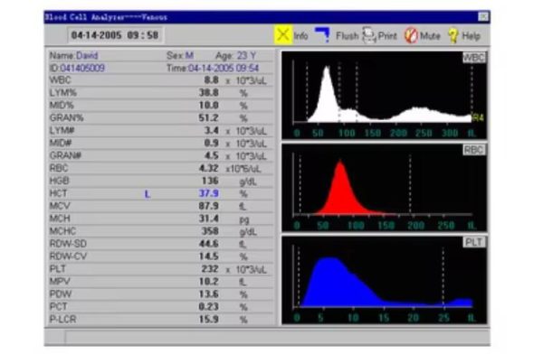 Full Auto Hematology Analyzer - Image 3